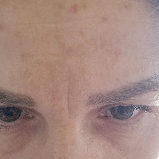 Hi ,please help me with my skin problem. I have this dark