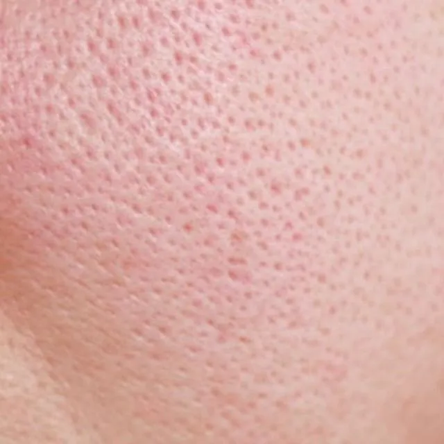 Hi, I'm looking for a product to help with large pores. 
