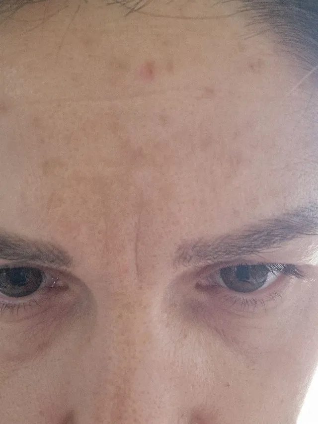 Hi ,please help me with my skin problem. I have this dark