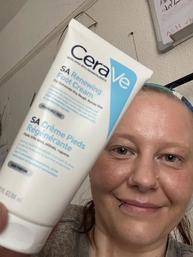 My skin story #meandcerave