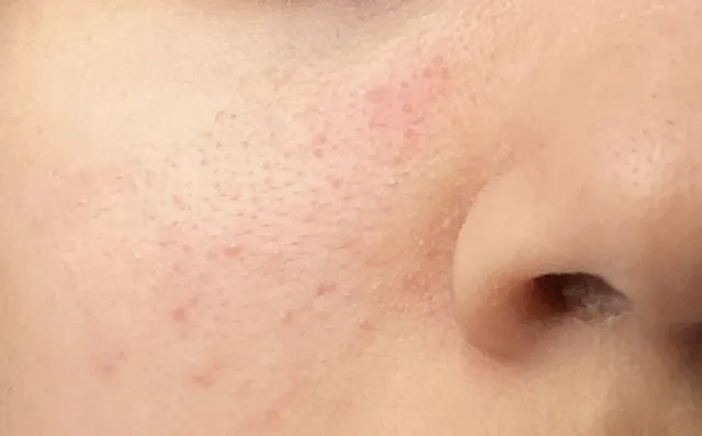 Hey there! I don’t know what to use for this skin problem.