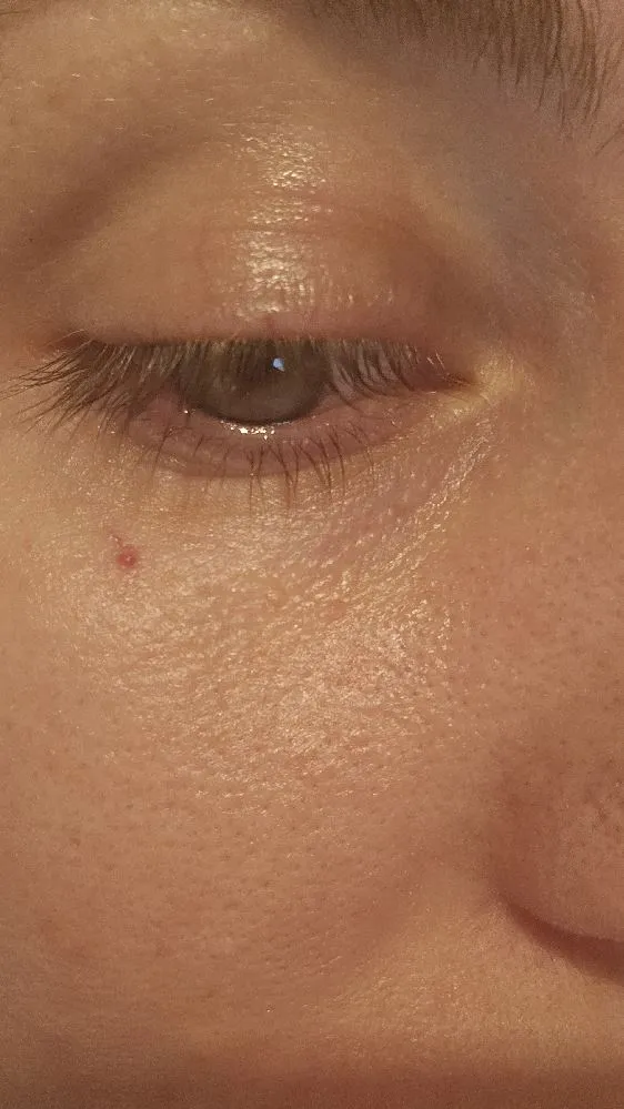 Dear Experts,  could you tell me what this red spot under my