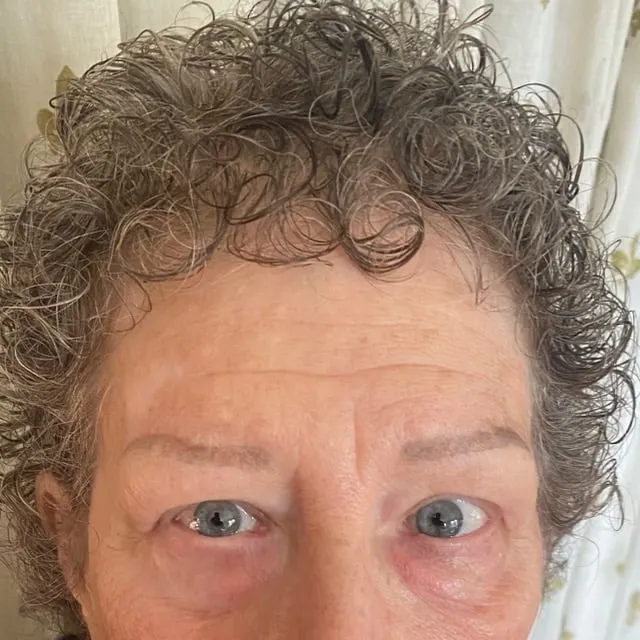 Eye cream update from a 71-year-old.