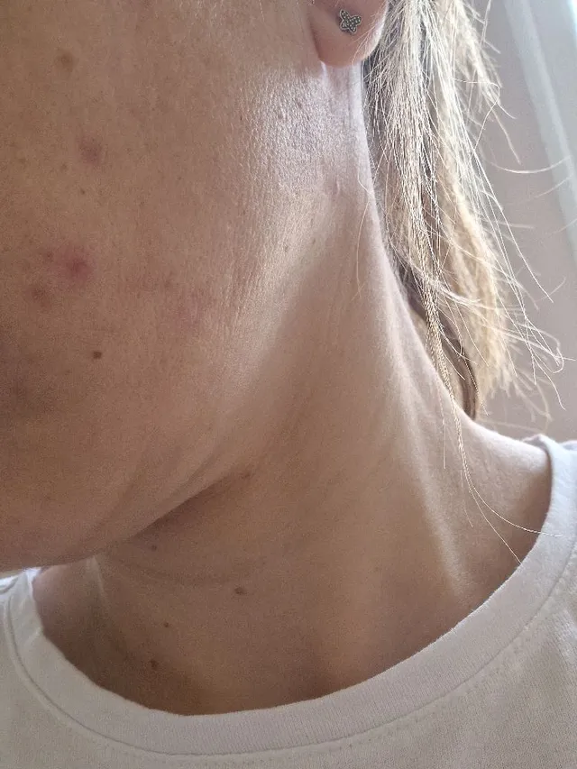 Hi ,please help me with my skin problem. I have this dark - 2